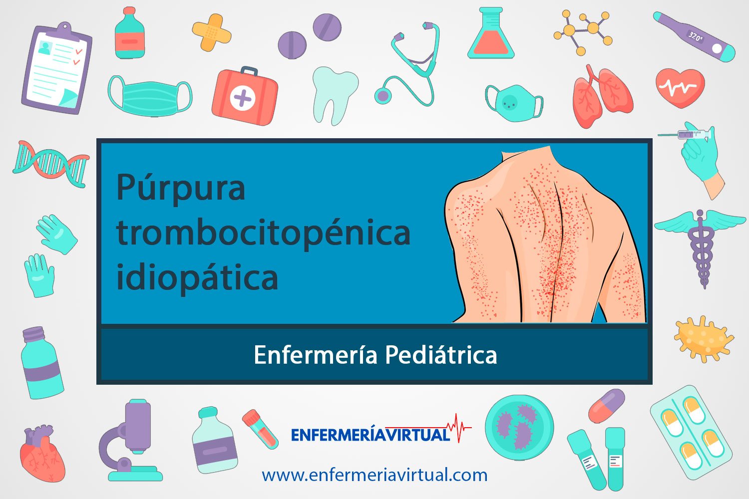 Púrpura trombocitopénica idiopática
