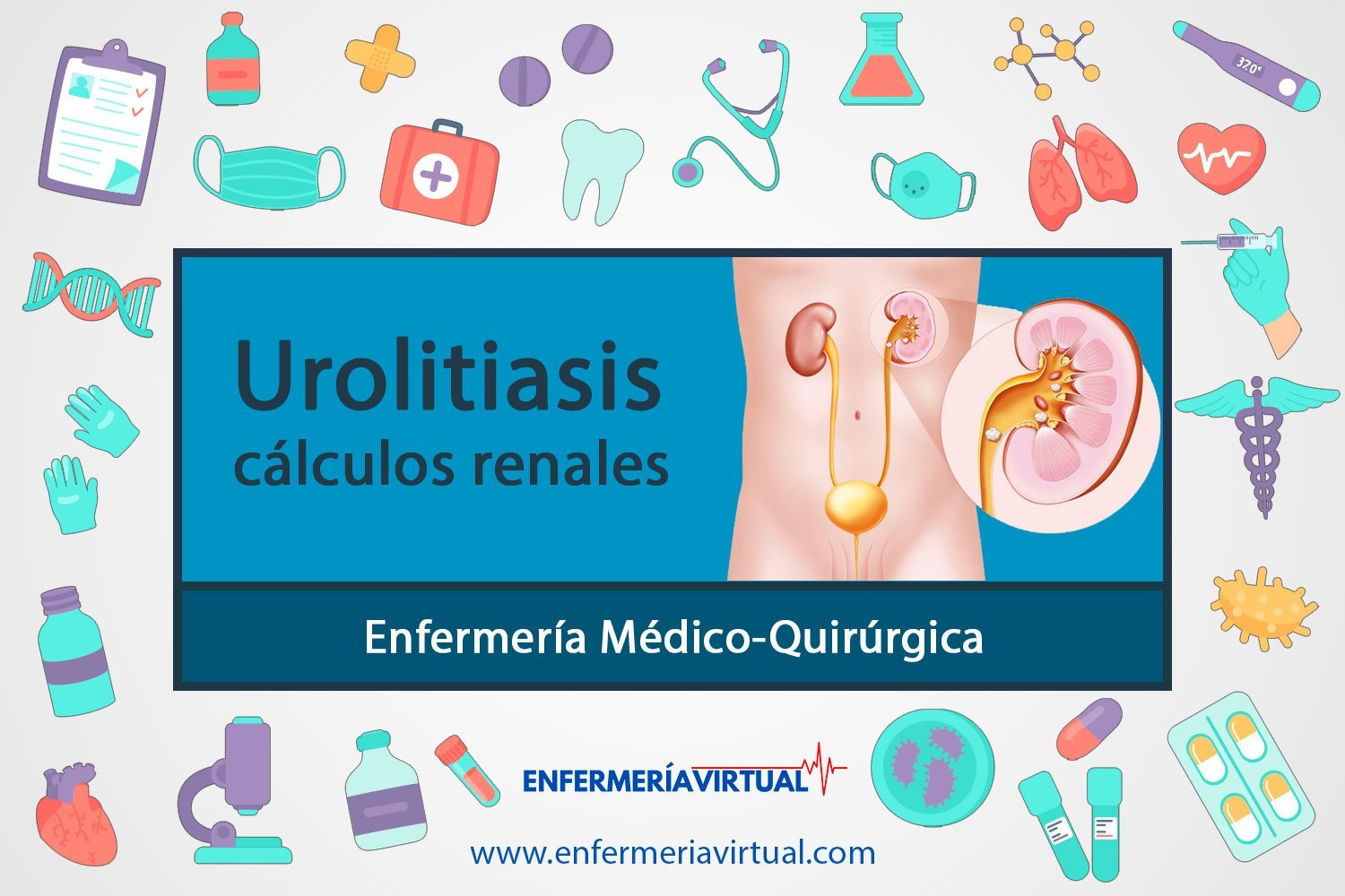 Urolitiasis (cálculos renales)