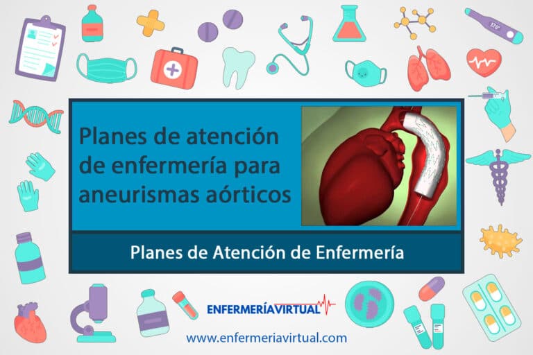 Planes de atención de enfermería para aneurismas aórticos